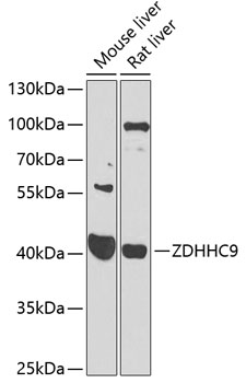 Western blot - ZDHHC9 Polyclonal Antibody 