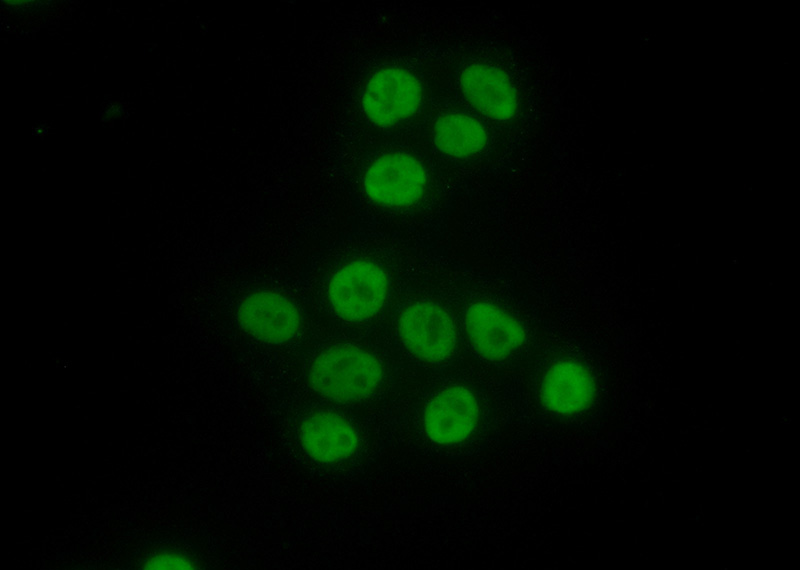 Immunofluorescent analysis of (10% Formaldehyde) fixed HeLa cells using Catalog No:112556(MCM6 Antibody) at dilution of 1:50 and Alexa Fluor 488-congugated AffiniPure Goat Anti-Rabbit IgG(H+L)