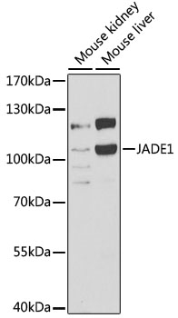 Western blot - JADE1 Polyclonal Antibody 