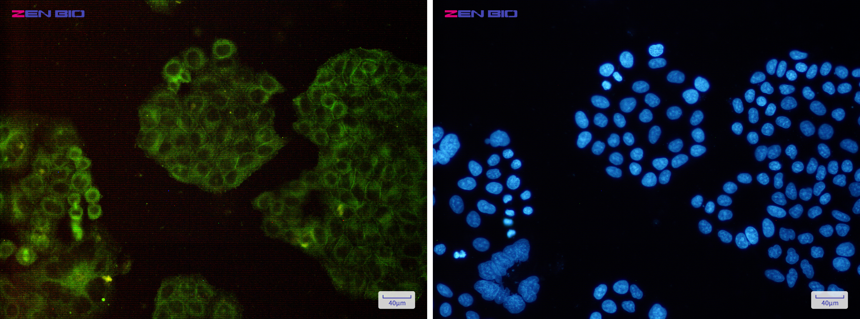 Immunocytochemistry of Arp3(green) in Hela cells using Arp3 Rabbit pAb at dilution 1/50, and DAPI(blue)