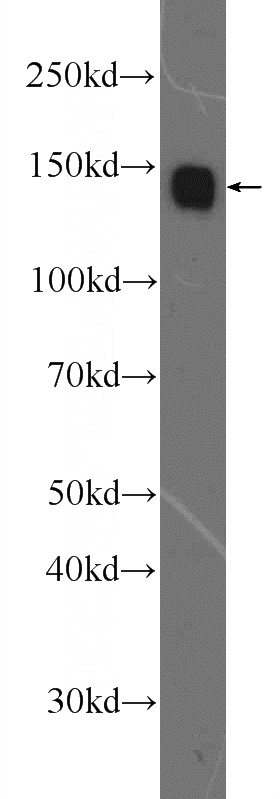 A431 cells were subjected to SDS PAGE followed by western blot with Catalog No:110217(EGFR Antibody) at dilution of 1:2000