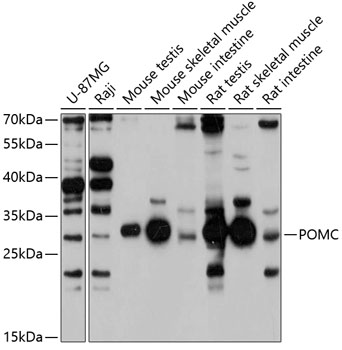 Western blot - POMC Polyclonal Antibody 
