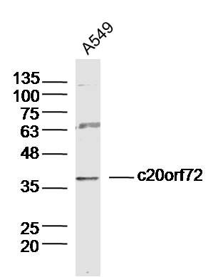Fig1: Sample:; A549 Cell (Human) Lysate at 30 ug; Primary: Anti- c20orf72 at 1/300 dilution; Secondary: IRDye800CW Goat Anti-Rabbit IgG at 1/20000 dilution; Predicted band size: 39kD; Observed band size: 39kD