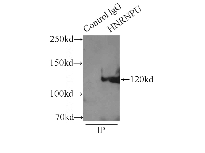 IP Result of anti-HNRNPU (IP:Catalog No:111513, 3ug; Detection:Catalog No:111513 1:800) with HeLa cells lysate 2000ug.