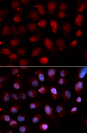 Immunofluorescence - Pea3 / ETV4 Polyclonal Antibody 
