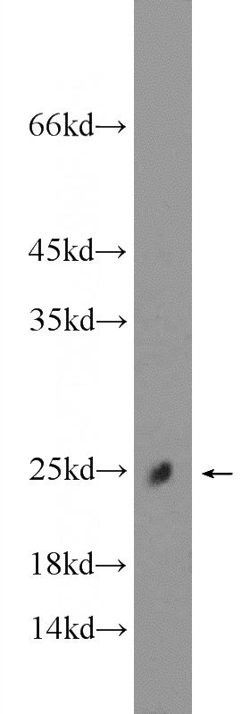 mouse skeletal muscle tissue were subjected to SDS PAGE followed by western blot with Catalog No:108644(C11orf74 Antibody) at dilution of 1:600