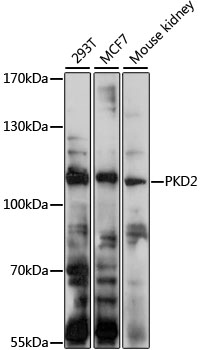 Western blot - PKD2 Polyclonal Antibody 