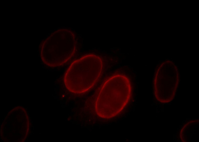 Immunofluorescent analysis of HepG2 cells, using S100A6 antibody Catalog No: at 1:25 dilution and Rhodamine-labeled goat anti-mouse IgG (red).