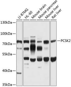 Western blot - PCSK2 Polyclonal Antibody 