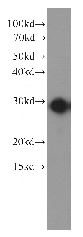 Recombinant protein were subjected to SDS PAGE followed by western blot with Catalog No:107402(IL6 antibody) at dilution of 1:10000