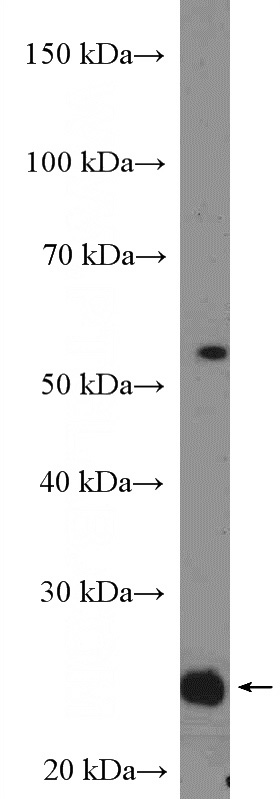 mouse brain tissue were subjected to SDS PAGE followed by western blot with Catalog No:114736(RNF11 Antibody) at dilution of 1:600