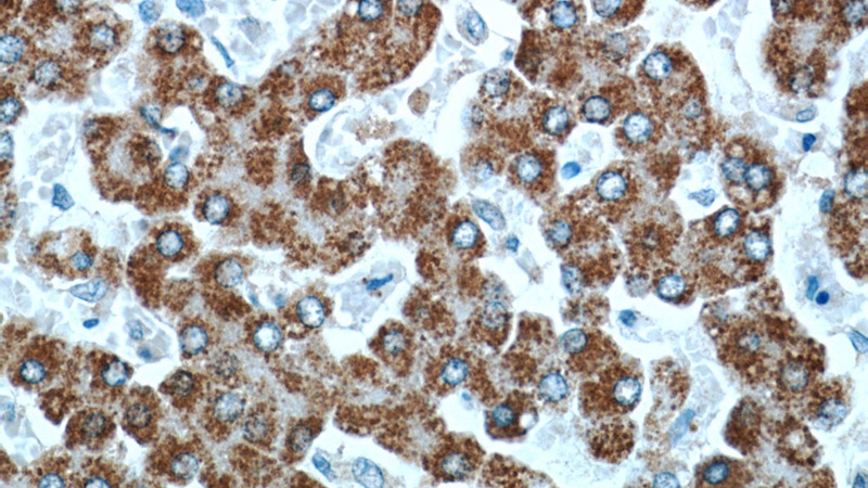 Immunohistochemical of paraffin-embedded human liver using Catalog No:113493(PAICS antibody) at dilution of 1:50 (under 40x lens)