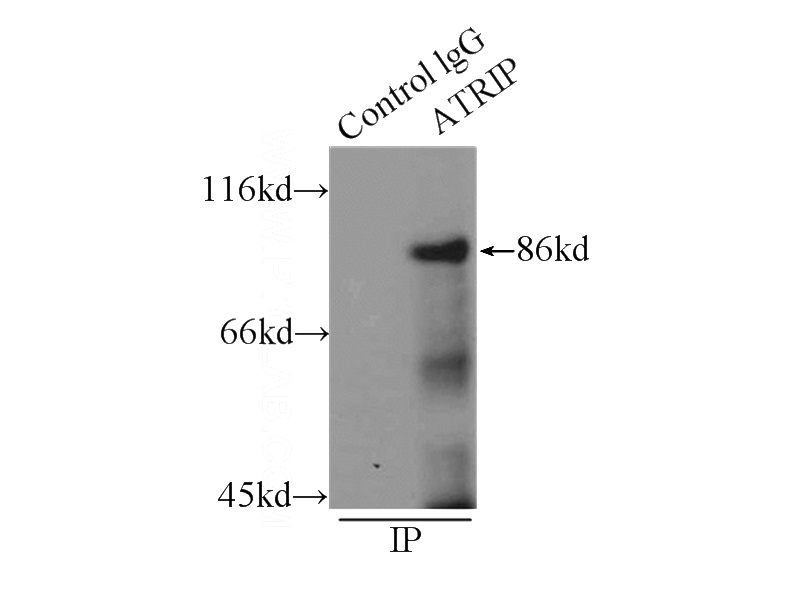 IP Result of anti-ATRIP (IP:Catalog No:108327, 3ug; Detection:Catalog No:108327 1:1000) with MCF-7 cells lysate 2800ug.