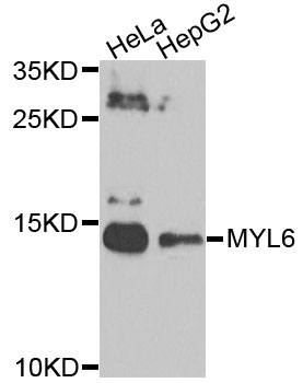 Western blot - MYL6 Polyclonal Antibody 