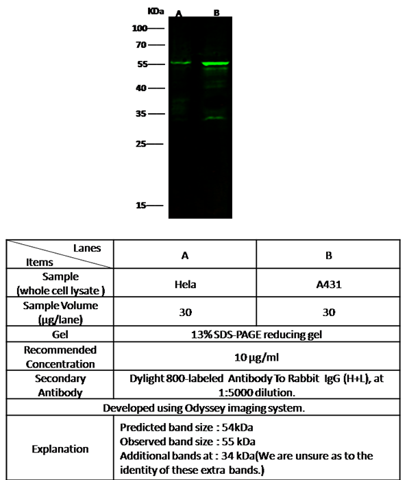 KRT8 / Cytokeratin8 Antibody, Rabbit PAb, Antigen Affinity Purified, Western blot
