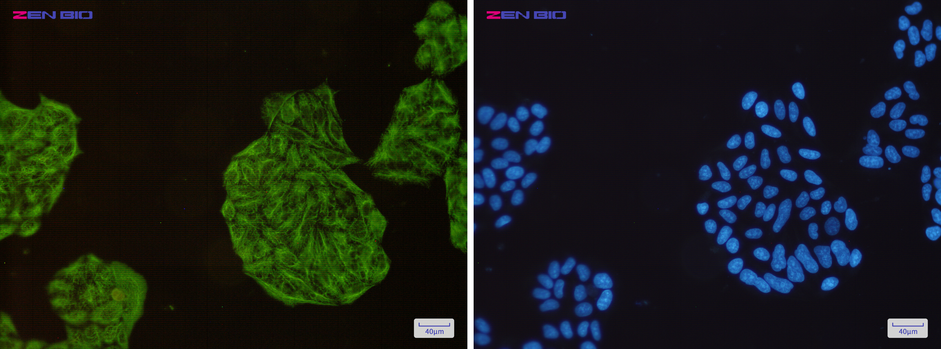 Immunocytochemistry of Cytokeratin 18(green) in Hela cells using Cytokeratin 18 Rabbit mAb at dilution 1/200, and DAPI(blue)