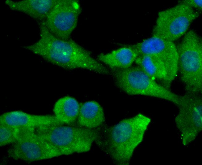 Fig4:; ICC staining of DLL4 in PMVEC cells (green). Formalin fixed cells were permeabilized with 0.1% Triton X-100 in TBS for 10 minutes at room temperature and blocked with 10% negative goat serum for 15 minutes at room temperature. Cells were probed with the primary antibody ( 1/50) for 1 hour at room temperature, washed with PBS. Alexa Fluor®488 conjugate-Goat anti-Rabbit IgG was used as the secondary antibody at 1/1,000 dilution. The nuclear counter stain is DAPI (blue).