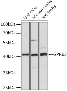 Western blot - GPR62 Polyclonal Antibody 