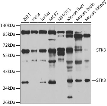 Western blot - STK3 Polyclonal Antibody 