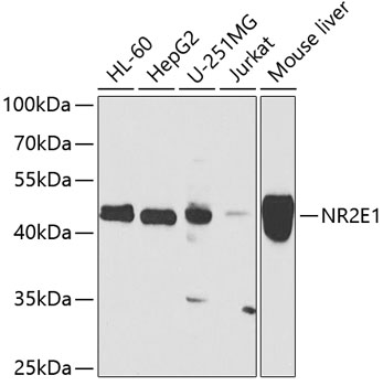 Western blot - NR2E1 Polyclonal Antibody 
