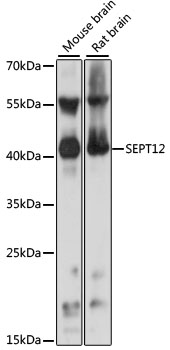 Western blot - SEPT12 Polyclonal Antibody 
