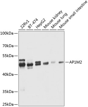 Western blot - AP1M2 Polyclonal Antibody 
