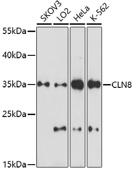 Western blot - CLN8 Polyclonal Antibody 