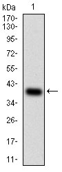 Western blot analysis using PTPRC mAb against human PTPRC (AA: 928-989) recombinant protein. (Expected MW is 33 kDa)