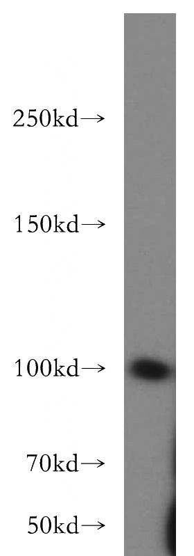 HeLa cells were subjected to SDS PAGE followed by western blot with Catalog No:111678(IGF1R-Specific antibody) at dilution of 1:400