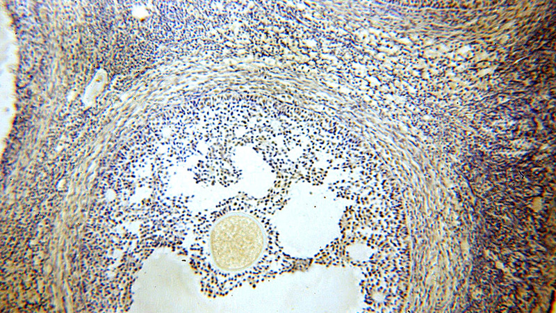 Immunohistochemical of paraffin-embedded human ovary using Catalog No:107707(ACTL6A antibody) at dilution of 1:50 (under 10x lens)