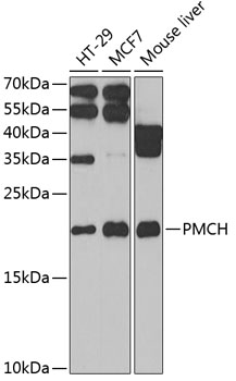 Western blot - PMCH Polyclonal Antibody 