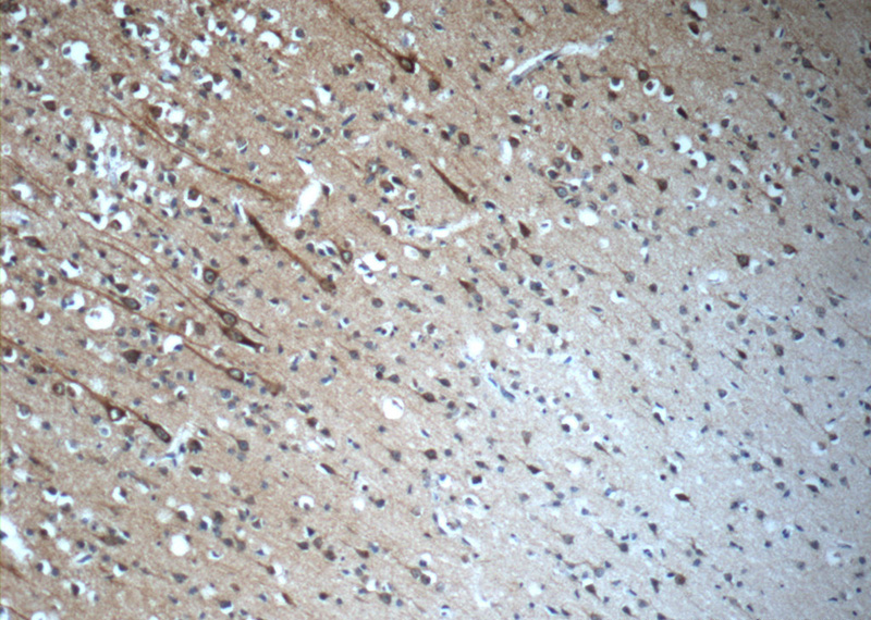 Immunohistochemistry of paraffin-embedded human brain slide using Catalog No:109181(KIAA1712 Antibody) at dilution of 1:50 (under 10x lens)