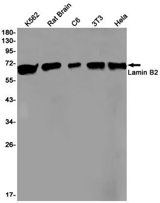 Western blot detection of Lamin B2 in K562,Rat Brain,C6,3T3,Hela cell lysates using Lamin B2 Rabbit pAb(1:1000 diluted).Predicted band size:68kDa.Observed band size:68kDa.