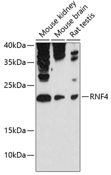 Western blot - RNF4 Polyclonal Antibody 