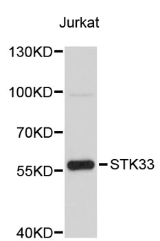 Western blot - STK33 Polyclonal Antibody 