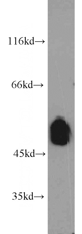 mouse brain tissue were subjected to SDS PAGE followed by western blot with Catalog No:116618(UNC5C-Specific antibody) at dilution of 1:1000