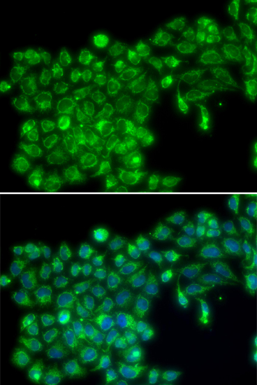 Immunofluorescence - TNFSF13 Polyclonal Antibody 