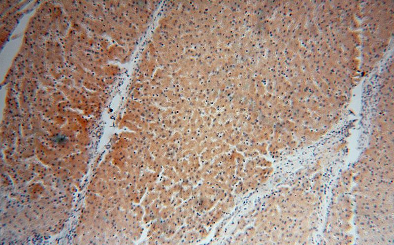 Immunohistochemical of paraffin-embedded human liver using Catalog No:115073(SDSL antibody) at dilution of 1:100 (under 10x lens)