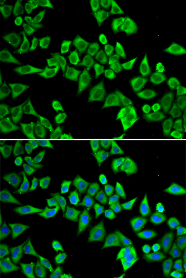 Immunofluorescence - DDX20 Polyclonal Antibody 