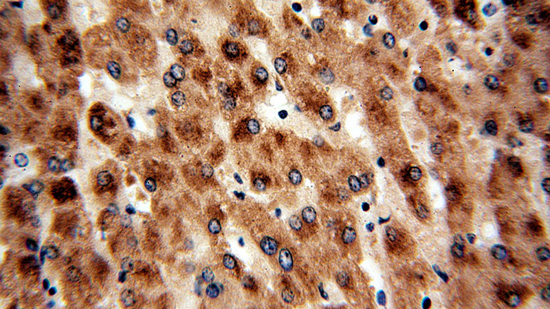 Immunohistochemical of paraffin-embedded human liver using Catalog No:116868(WDR45 antibody) at dilution of 1:50 (under 40x lens)