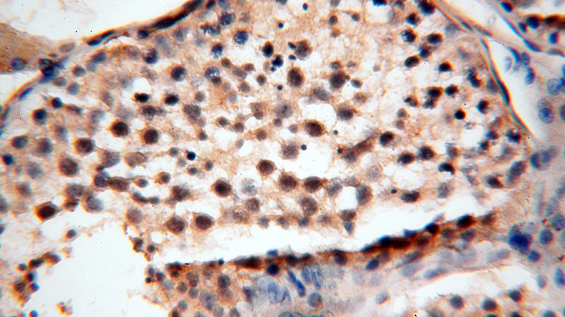 Immunohistochemical of paraffin-embedded human testis using Catalog No:108951(CC2D1A antibody) at dilution of 1:100 (under 40x lens)