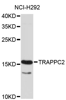Western blot - TRAPPC2 Polyclonal Antibody 