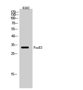 Fig1:; Western Blot analysis of K562 cells using FoxE3 Polyclonal Antibody cells nucleus extracted by Minute TM Cytoplasmic and Nuclear Fractionation kit (SC-003,Inventbiotech,MN,USA).