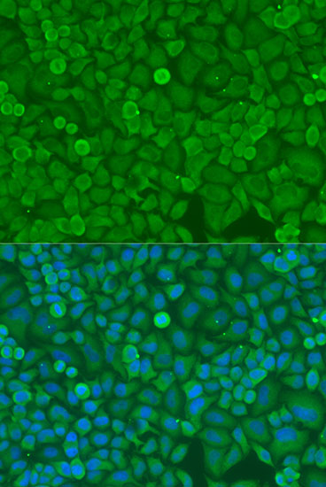 Immunofluorescence - DICER1 Polyclonal Antibody 