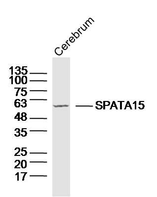 Fig1: Sample: Cerebrum (Mouse) Lysate at 40 ug; Primary: Anti-SPATA15/SPATC1 at 1/300 dilution; Secondary: IRDye800CW Goat Anti-Rabbit IgG at 1/20000 dilution; Predicted band size: 62kD; Observed band size: 62kD
