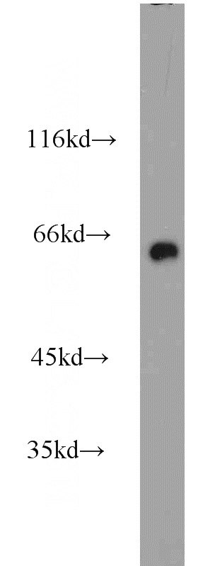 mouse brain tissue were subjected to SDS PAGE followed by western blot with Catalog No:109569(CRMP1 antibody) at dilution of 1:1000