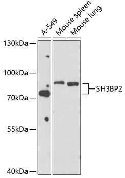 Western blot - SH3BP2 Polyclonal Antibody 