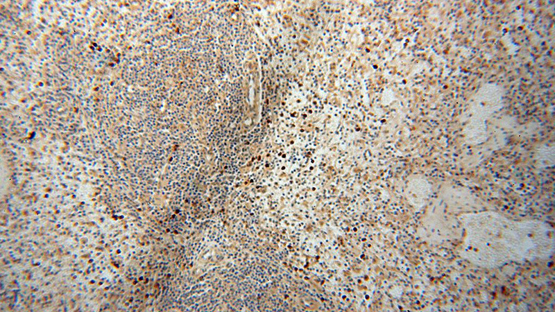 Immunohistochemical of paraffin-embedded human spleen using Catalog No:113596(PARP9 antibody) at dilution of 1:50 (under 10x lens)