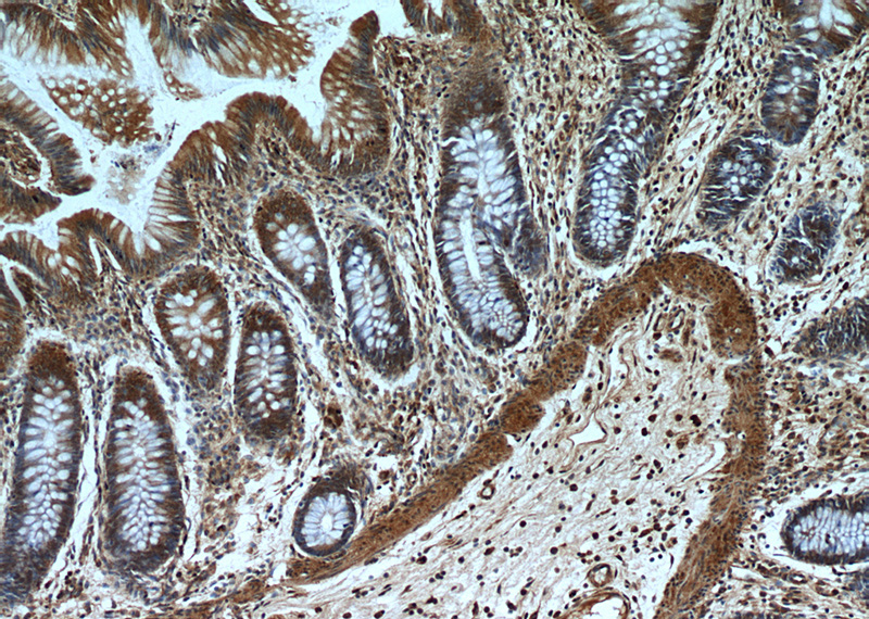 Immunohistochemical of paraffin-embedded human colon using Catalog No:110469(FAM127B antibody) at dilution of 1:100 (under 10x lens)