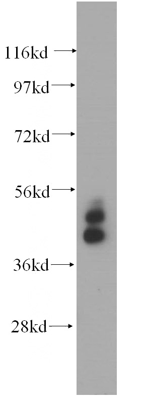 MCF7 cells were subjected to SDS PAGE followed by western blot with Catalog No:109801(KRT19 antibody) at dilution of 1:500